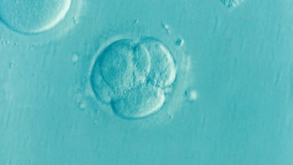 embryo, ivf, microfertilization, infertility, fertility, embryo, embryo, embryo, embryo, embryo, ivf, ivf, ivf, ivf, infertility